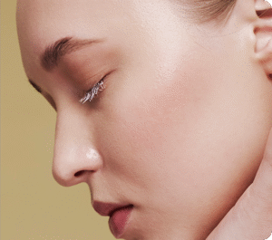 تزریق فیلر بینی جهت اصلاح فرم - بعد از درمان